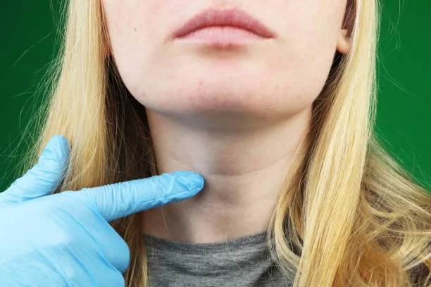Thyroid. The girl on examination at the doctor.